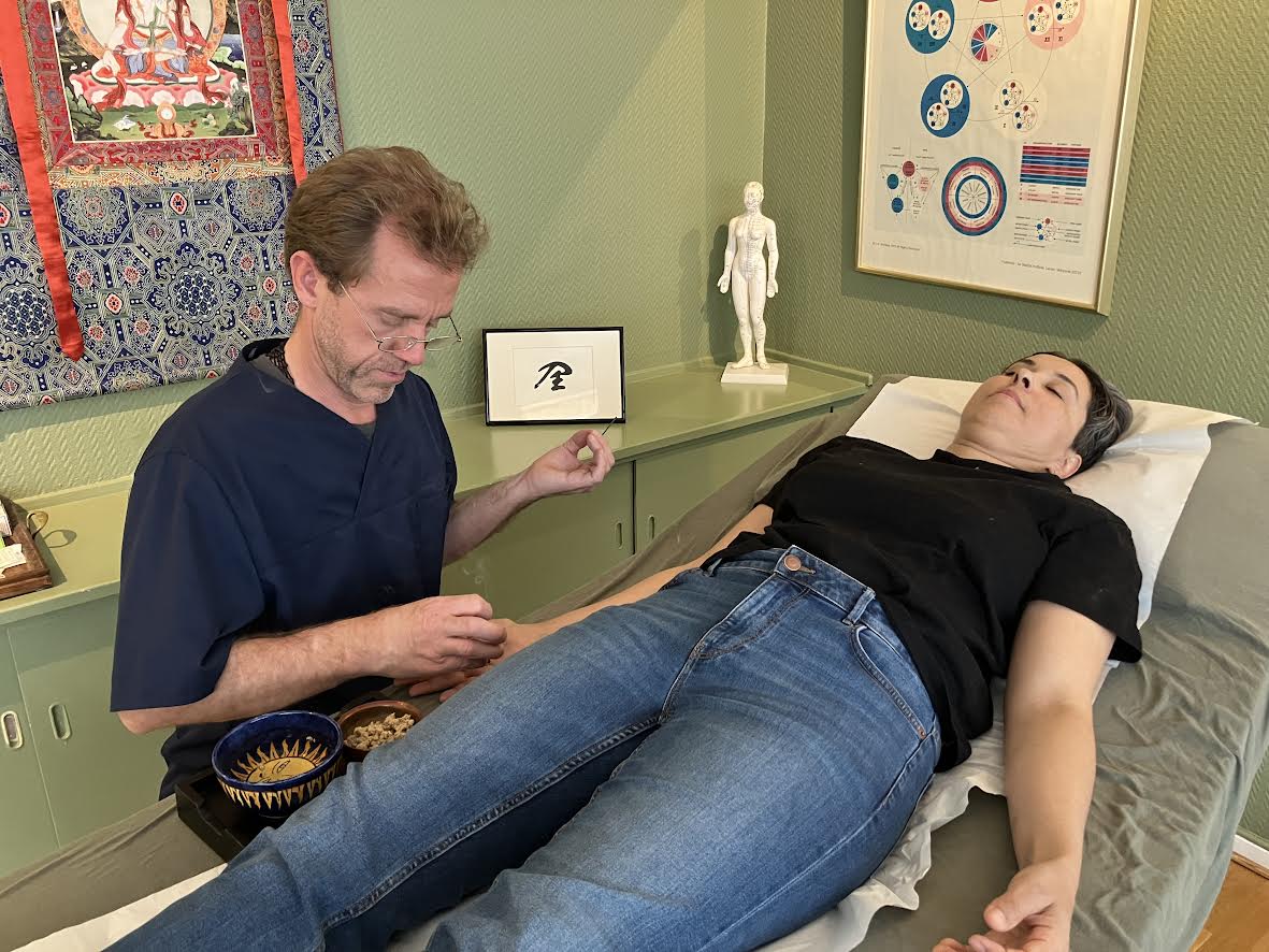 Akupunktur og moxa behandling